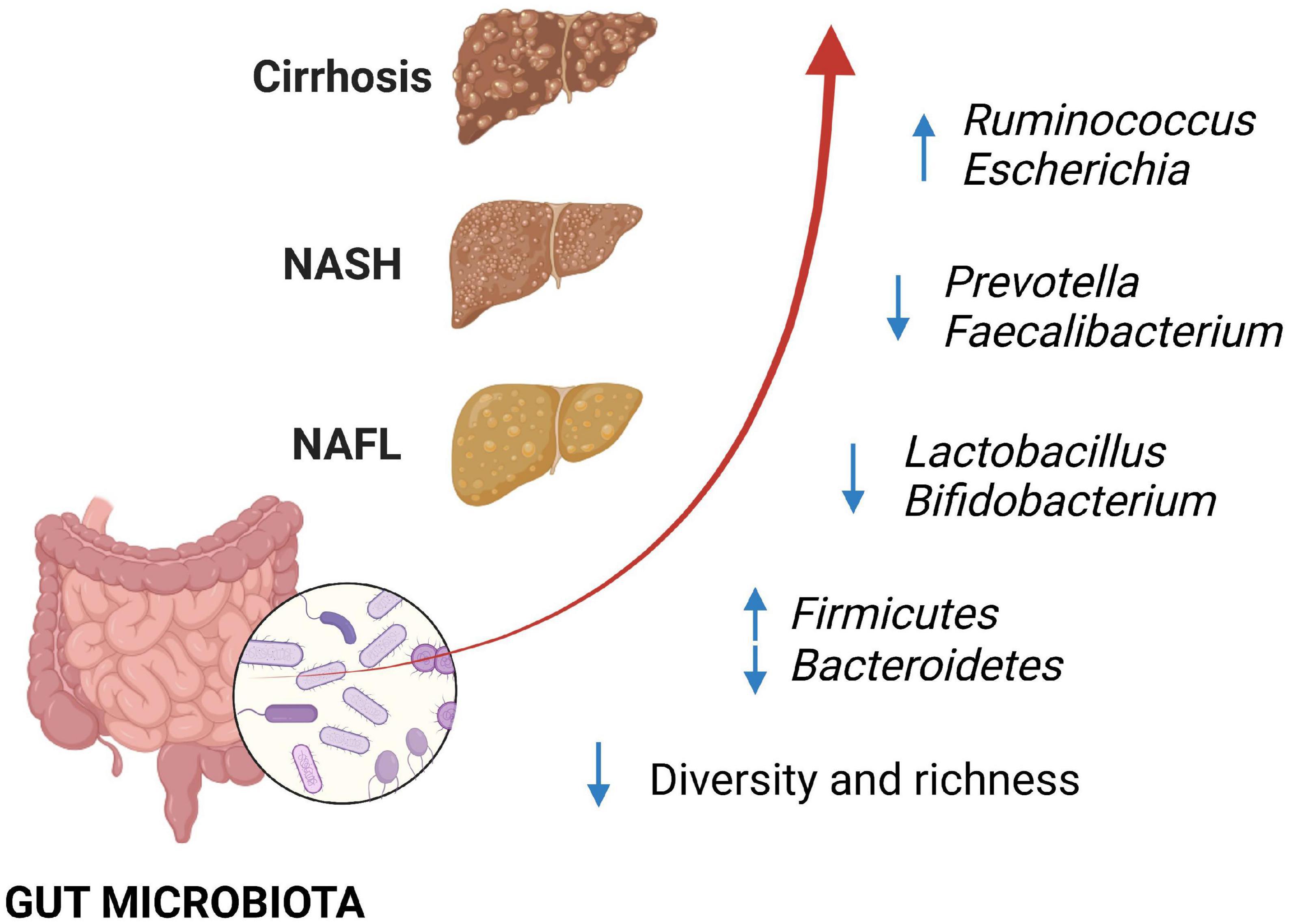 Gut microbiota modulation in patients with non-alcoholic fatty liver disease: Effects of current treatments and future strategies